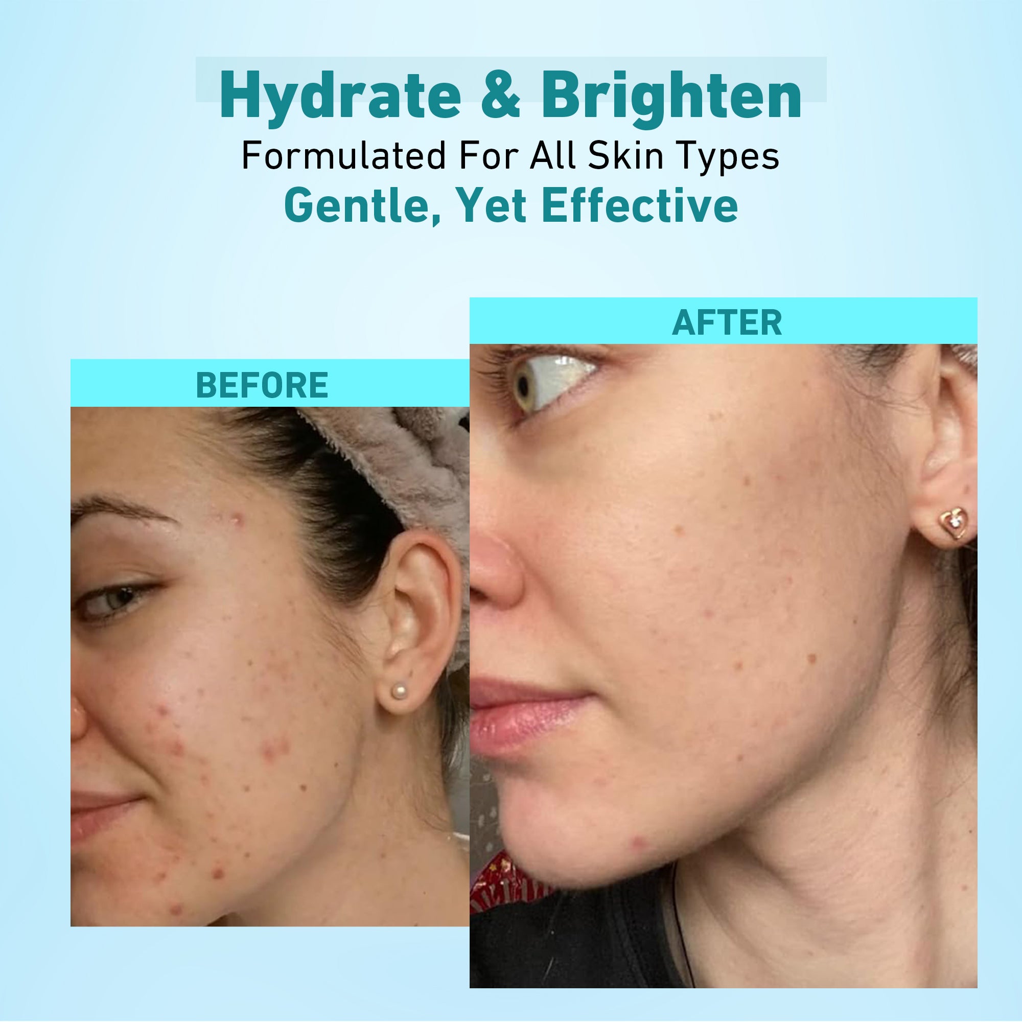 KYING® Hyaloeronic Glow Ampoule Serum (Korean Beauty), 30ml