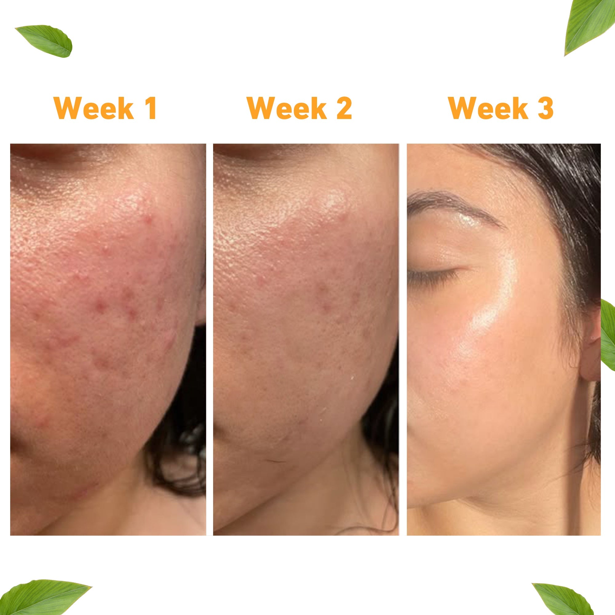 #Kying #hyaloeronic #knowyouringredients #hyaluronicacid #cleanser #facewash #kyingcleanser #kyingmoisturizer #kyingserum #koreaserum #koreanbeuty #hyaluronic