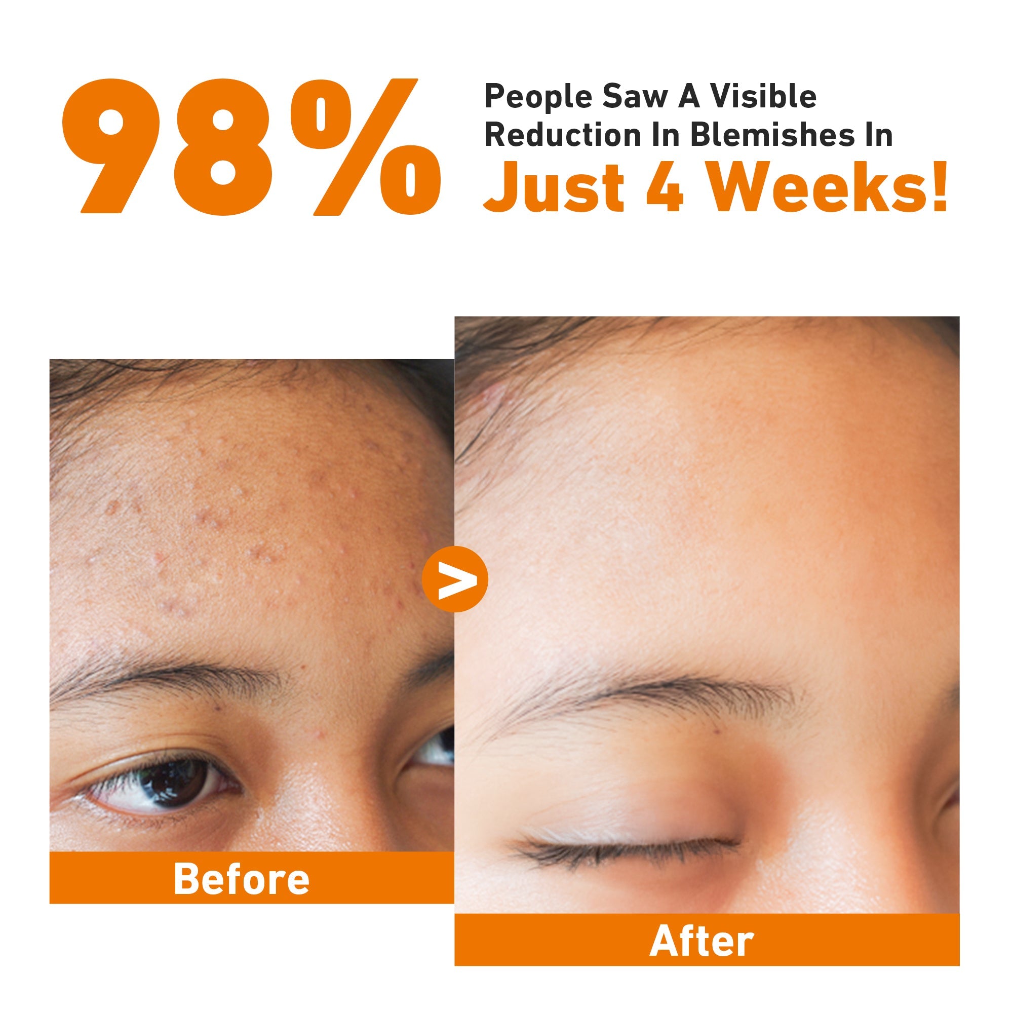 #Kying #hyaloeronic #knowyouringredients #hyaluronicacid #cleanser #facewash #kyingcleanser #kyingmoisturizer #kyingserum #koreaserum #koreanbeuty #hyaluronic