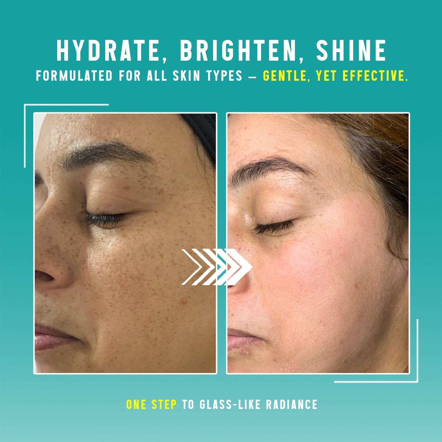 #Kying #hyaloeronic #knowyouringredients #hyaluronicacid #cleanser #facewash #kyingcleanser #kyingmoisturizer #kyingserum #koreaserum #koreanbeuty #hyaluronic